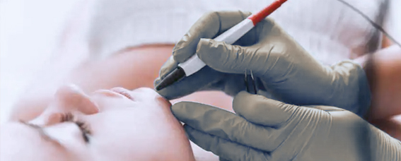 Electrolysis